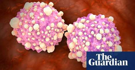 New blood test can detect 50 types of cancer | Science | #Research | 21st Century Innovative Technologies and Developments as also discoveries, curiosity ( insolite)... | Scoop.it