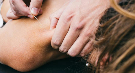 Acupuncture for Myofascial Pain Syndrome: the Ultimate Guide | Call: 915-850-0900 | Chiropractic + Wellness | Scoop.it