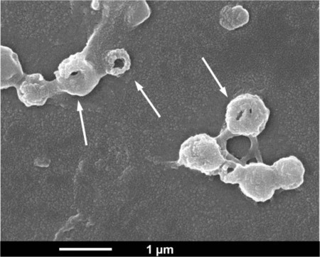 Superbug-killing coating "magnetically" draws in bacteria | Longevity science | Scoop.it
