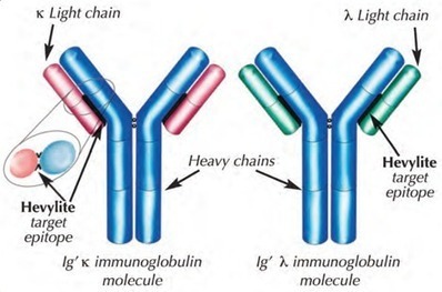 Accurate measurement of intact Igs allows improved monitoring of Multiple Myeloma patients. | Immunology Diagnosis | Scoop.it