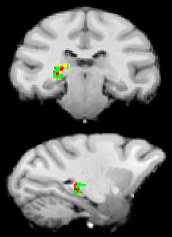 New study reveals the brain's mysterious switchboard operator - the pulvinar | Amazing Science | Scoop.it