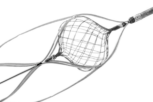 Vesalio introduces NeVa NET 4mm for acute ischaemic stroke due to large vessel occlusion | Neurovascular Intervention | Scoop.it