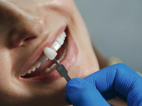 Partial Denture Options For Replacing Missing Teeth | Smilepoint Dental Group | Scoop.it