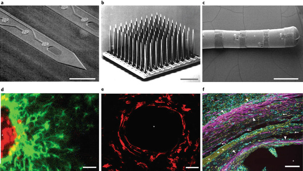More Than Cell Markers: Understanding Heterogeneous Glial Responses to Implantable Neural Devices | Brain Computer Interfaces & connected medical devices | Scoop.it