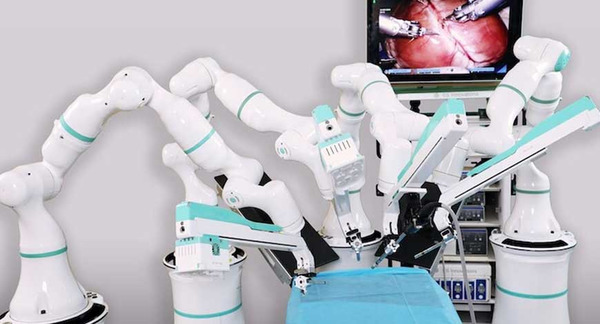 SS Innovations’ SSi Mantra Surgical Robotic System used to perform Mitral Valve Replacement | Transcatheter Treatment of Mitral Regurgitation | Scoop.it