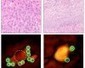 Global Molecular Diagnostics Market: Asia is expected to show high growth rates by 2015 to 2021 | In-Vitro Diagnostic | Scoop.it