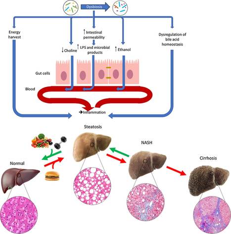 Le microbiote intestinal : un acteur des pathologies hépatiques | Life Sciences Université Paris-Saclay | Scoop.it