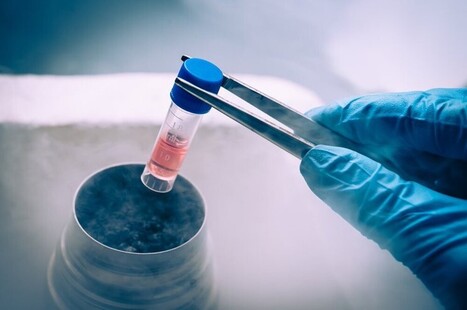 Mise en œuvre des techniques de préservation de la fertilité : de nouvelles réflexions menées par l'Université Paris-Saclay et Sorbonne Université | Life Sciences Université Paris-Saclay | Scoop.it