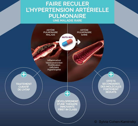 Un candidat médicament pour soigner l'hypertension artérielle pulmonaire | Life Sciences Université Paris-Saclay | Scoop.it