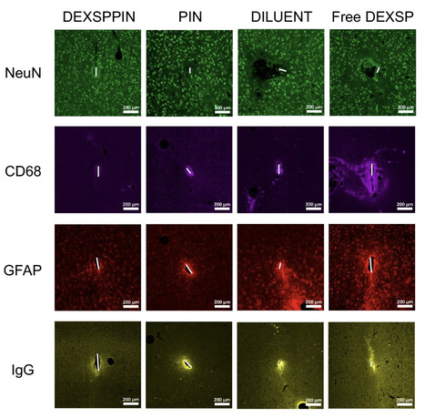 Dexamethasone-loaded platelet-inspired nanoparticles improve intracortical microelectrode recording performance&nbsp; | Brain Computer Interfaces & connected medical devices | Scoop.it