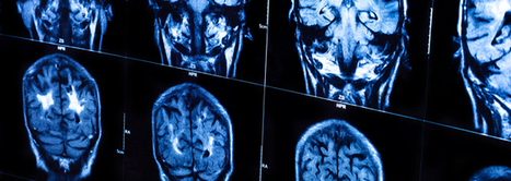 Good brain, bad brain: basics — University of Birmingham — FutureLearn | Into the Driver's Seat | Scoop.it