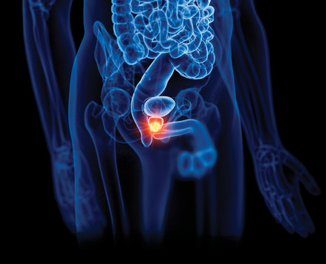 How to Keep Your Prostate Healthy&mdash;And How to Tell When Something&rsquo;s Up With It | The Health Report | Scoop.it