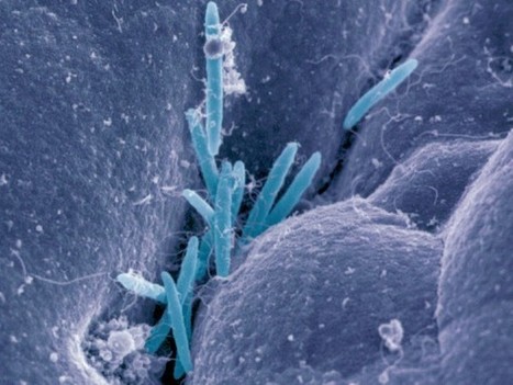 A gut microbe that stops food allergies | Allergy (and clinical immunology) | Scoop.it
