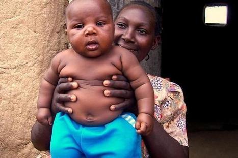 L’obésité, le nouveau fléau qui frappe l'Afrique | Actualités Afrique | Scoop.it