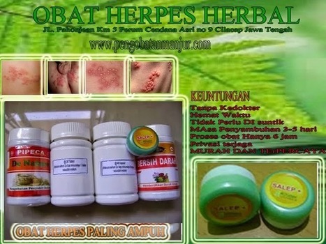 Cara Mengobati Herpes Di Muka 4280redwoodsanr