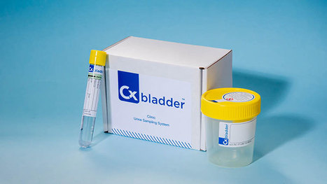 Urine-Based, Non-Invasive Molecular Test Accurately Detects Bladder Cancer | In-Vitro Diagnostic | Scoop.it