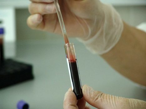 Long-Lived Antibodies Detected in Both Blood and Saliva of Patients With COVID-19 | Mucosal Immunity | Scoop.it