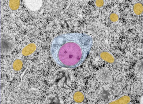 LGG-1/GABARAP lipidation is not required for autophagy and development in Caenorhabditis elegans | I2BC Paris-Saclay | Scoop.it