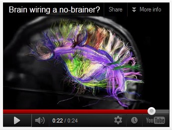 The Symphony Inside Your Brain | NIH Director's Blog | NIH Director's Blog - video | News from the world - nouvelles du monde | Scoop.it