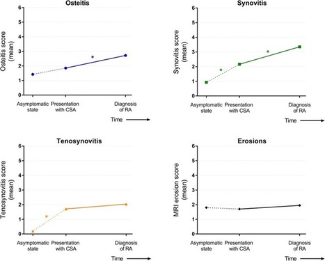 Sequence of joint tissue inflammation during rheumatoid arthritis development | Arthritis Research & Therapy | Full Text | Rheumatology-Rhumatologie | Scoop.it