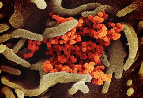 Janssen Investigational COVID-19 Vaccine: Interim Analysis of Phase 3 Clinical Data Released | Virus World | Scoop.it