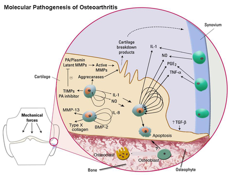 Tanezumab (Pfizer ) Review: Chronic Pain Relief - un knol de Krishan Maggon | L'arthrose | Scoop.it