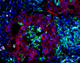 Immune Cells Recruited to Support Lung Cancer Growth Could Offer New Drug ... - Cornell Chronicle | Immunology and Biotherapies | Scoop.it