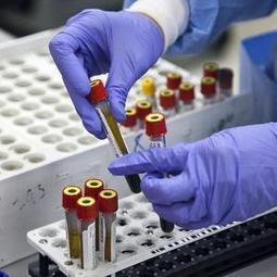 Direct-to-consumer testing: Taking the doctor out of the doctor's orders? - Kansas.com | Laboratory Medicine | Scoop.it