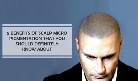 Hair Tattoo Micro Pigmentation In Scalp Micropigmentation Scoop It