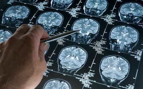 Un neuroscientifique montre ce que le jeûne fait pour votre cerveau et pourquoi big pharma ne va pas l’étudier – On sait ce qu'on veut qu'on sache | La Sagesse de la Nature | Scoop.it