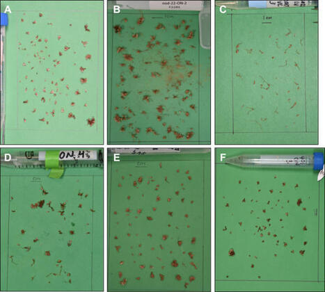 Estimating Rhizobial Fitness During Legume Symbiosis: Enriching Viable Undifferentiated Bacteria from Root Nodules | Plant-Microbe Symbiosis | Scoop.it