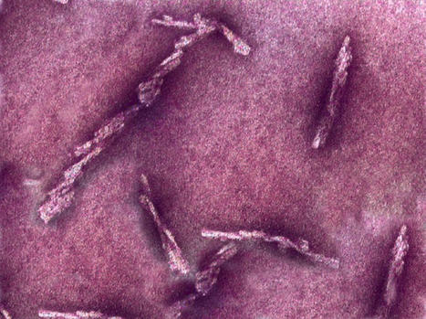 New hints how disease spreads in the brain: Unraveling the origin of Alzheimer&rsquo;s disease | Amazing Science | Scoop.it