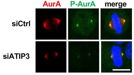 Contr&ocirc;ler l'int&eacute;grit&eacute; du fuseau mitotique en r&eacute;gulant la kinase Aurora A | Life Sciences Universit&eacute; Paris-Saclay | Scoop.it