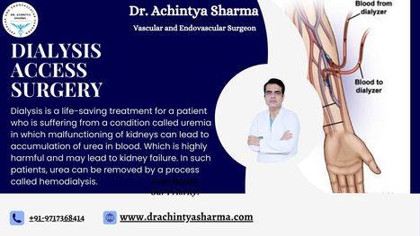 Navigating Vascular Routes: Understanding Dialysis Access Surgery | Dr. Achintya Sharma - Vascular and Endovascular Surgeon | Scoop.it