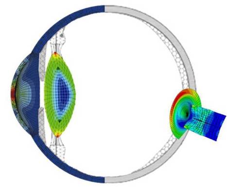 Investigadores europeos diseñan un topógrafo 3D para mejorar cirugía ocular | Salud Visual 2.0 | Scoop.it
