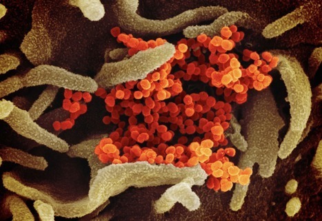 Factors Associated With COVID-19-related Death  | dis.infected | Scoop.it