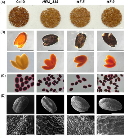 Un criblage de mutants affectés dans le ratio huile/protéines des graines identifie un nouvel allèle transparent testa7 | Life Sciences Université Paris-Saclay | Scoop.it