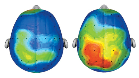 Child's Play: How Physical Activity May Impact Kids' Brains | Playfulness | Scoop.it