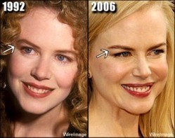 Supercinema Nicole Kidman E L Abisso Del Boto