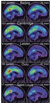 Women Are Better Connected… Neurally | Science News | Scoop.it