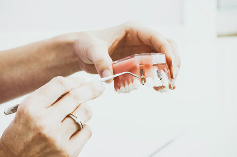 What Are Dental Crowns? | Navigating Healthcare | Medical and Health | Scoop.it
