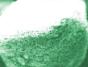 Glucose Sensing Sponge Delivers Insulin Precisely When and Where Needed | Healthcare: reloaded... | Scoop.it