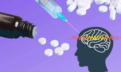 Psychiatric Comorbidities and Healthcare Utilization increase 5 years prior in Idiopathic Generalized Epilepsy: Study | Case Management in Health Care | Scoop.it