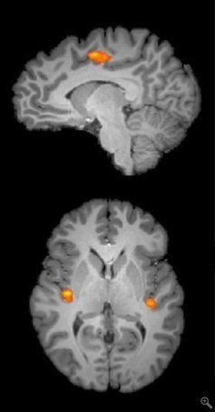 When people worry about math, the brain feels the pain | Science News | Scoop.it