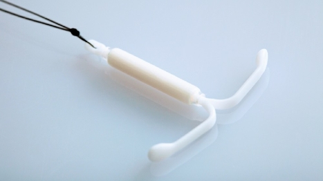 Stérilet hormonal Mirena : les Françaises dénoncent une omerta sur les effets secondaires | sida | Scoop.it