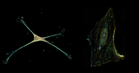 Parecen neuronas pero no lo son: las curiosas células que habitan en tu cerebro | Mi Cajón de Ideas | Scoop.it