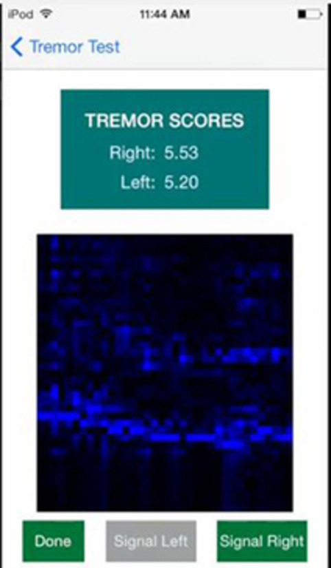 Researchers develop app to determine if a patient is faking alcohol tremors | Social Health on line | Scoop.it