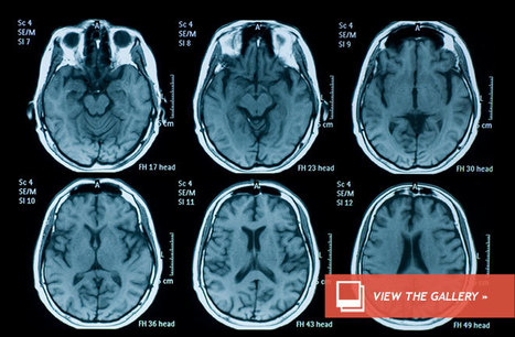 Does the Brain Have an Evil 'Dark Patch'? | Didactics and Technology in Education | Scoop.it