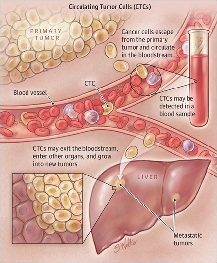 Circulating Tumor Cells | from Flow Cytometry to Cytomics | Scoop.it