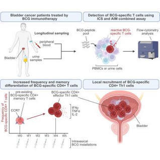 BCG immunotherapy for bladder cancer triggers s...